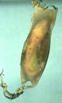 Dogfish (Scyliorhinus caniculus)